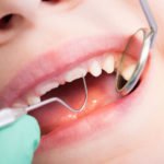 kid-dental