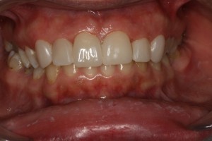 IMG 0492
