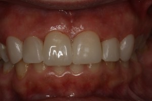 IMG 0493