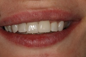 IMG 0494