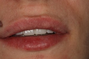 IMG 0495
