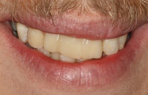 IMG 1409