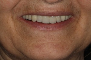 IMG 1500