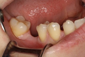 IMG 0081