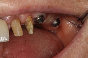 IMG 0485