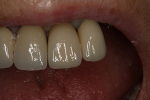 IMG 0486