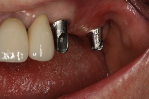 IMG 0487