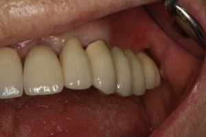 IMG 0488