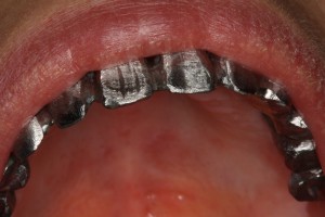 IMG 0506