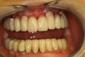 IMG 0546