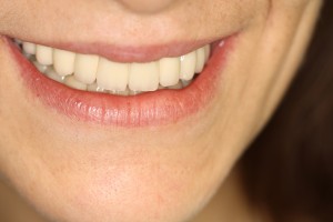 IMG 0548