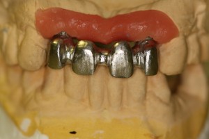 IMG 0778