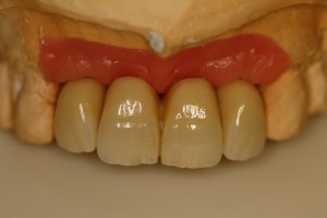 IMG 0793