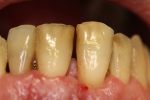 IMG 0394