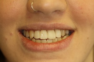 IMG 0951