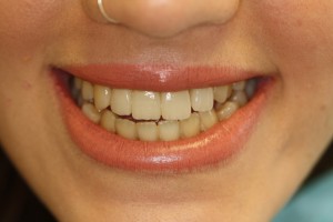 IMG 0958