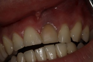 IMG 0448