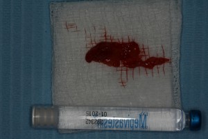 IMG 0455
