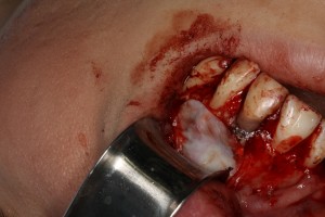 IMG 0468