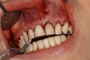 IMG 0476