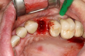 IMG 0174