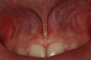 IMG 0719