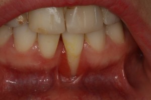 IMG 0743
