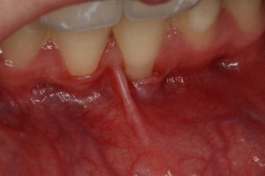 IMG 0744