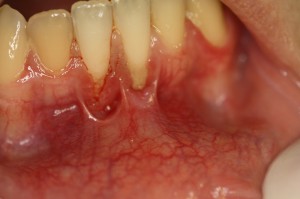 IMG 0944