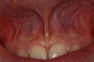 IMG 0719