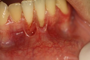 IMG 0944